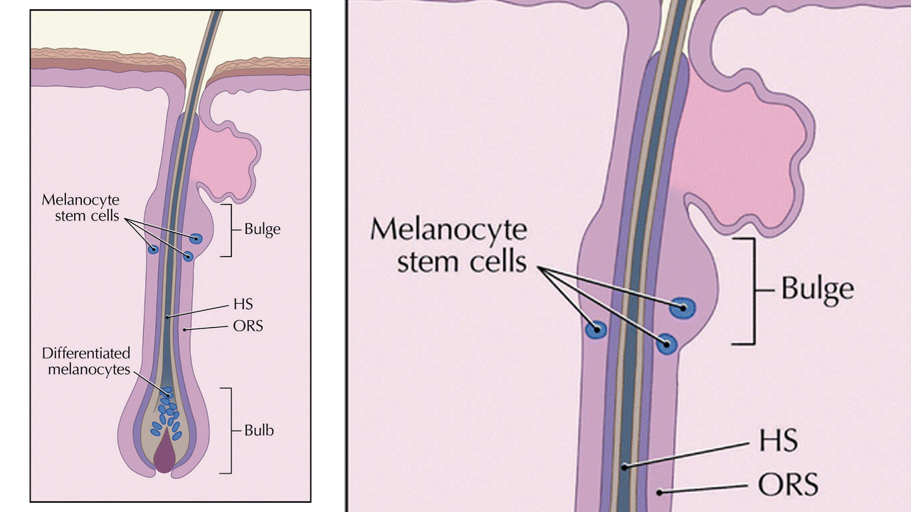 Saçlarımızın Neden Beyazladığı ‘Tam Olarak’ Bulundu: Peki Bu Durum Engellenebilir mi?