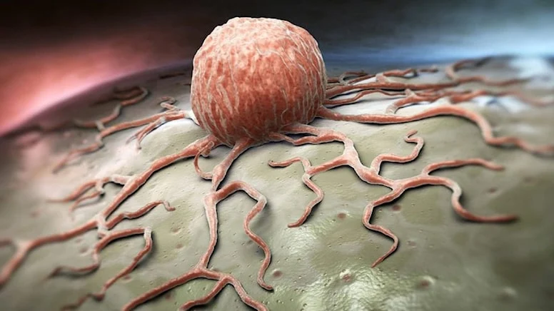 Günde 4,5 dakikayla kanser riskinizi azaltabilirsiniz