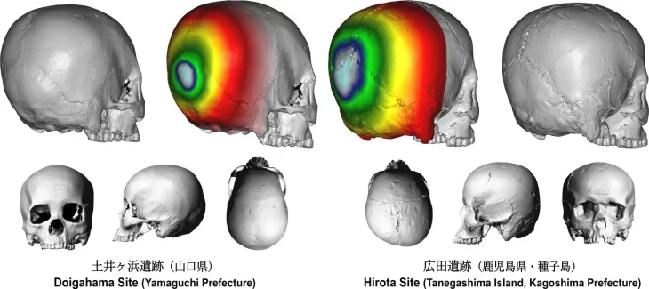 Japonya’nın Eski Kranial Modifikasyon Uygulaması: Tanegashima’daki Hirota halkı