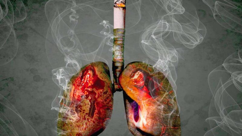 Orta Doğu Ülkelerinde Kansere Yakalanma Oranı Dünyanın Geri Kalanına Kıyasla Neden Daha Az?