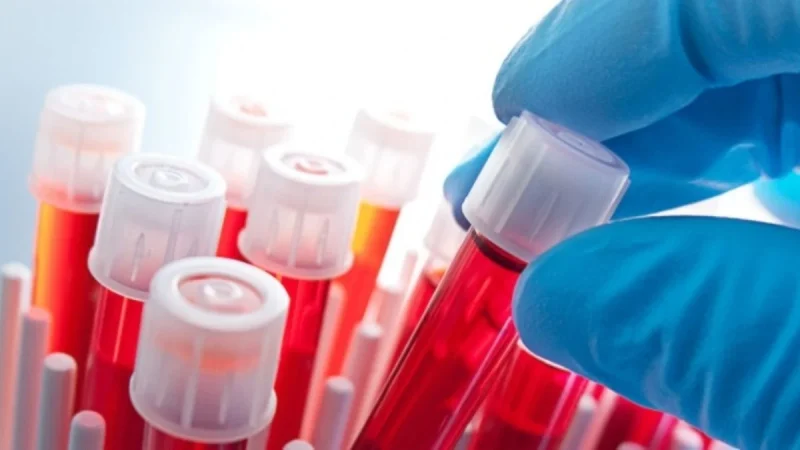 “Yemiyorum ama kilo alıyorum” diyen dikkat! Hemen bu testi yaptırın..