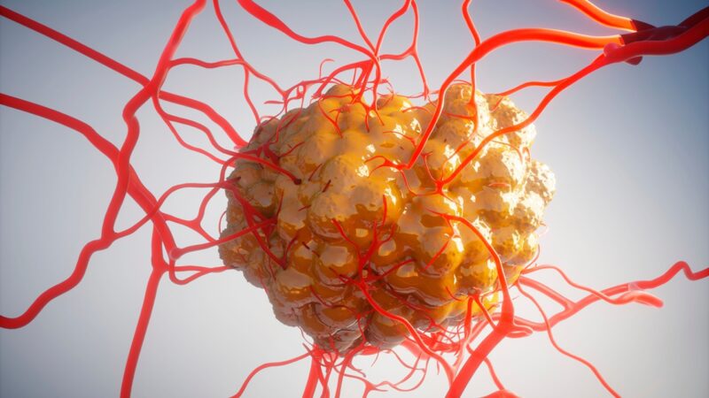 Kanser Hücrelerinin “Kendi Kendini İmhâ” Etmesinin Yolu Bulundu