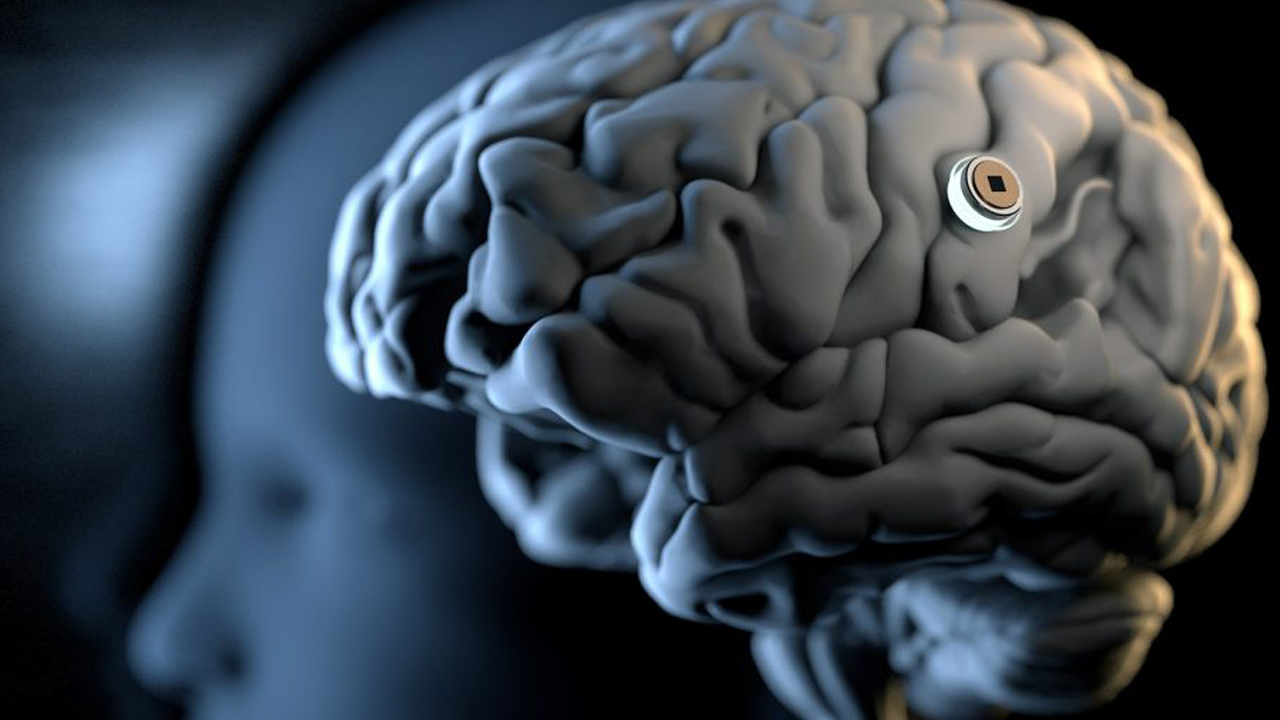 Elon Musk, Bir Felakete Neden Olabilir! Neuralink’in İnsan Beynine Taktığı Çip, Tam Olarak Ne İşe Yarıyor ve Nasıl Çalışıyor?