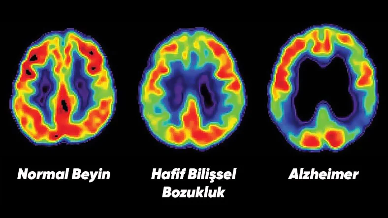 Zihninizi Sherlock Gibi Kullanmanızı Sağlayacak Ezber ve Hatırlama Metodu: Hafıza Sarayı