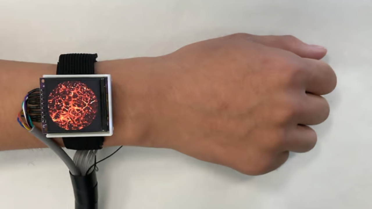 Damarlarınızdaki Kan Akışını Anlık Olarak Gösteren “Tıbbi Akıllı Saat” Geliştirildi