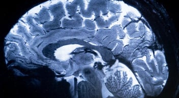 İnsan Beyninin En Net MRI Tarama Görüntüleri Çekildi