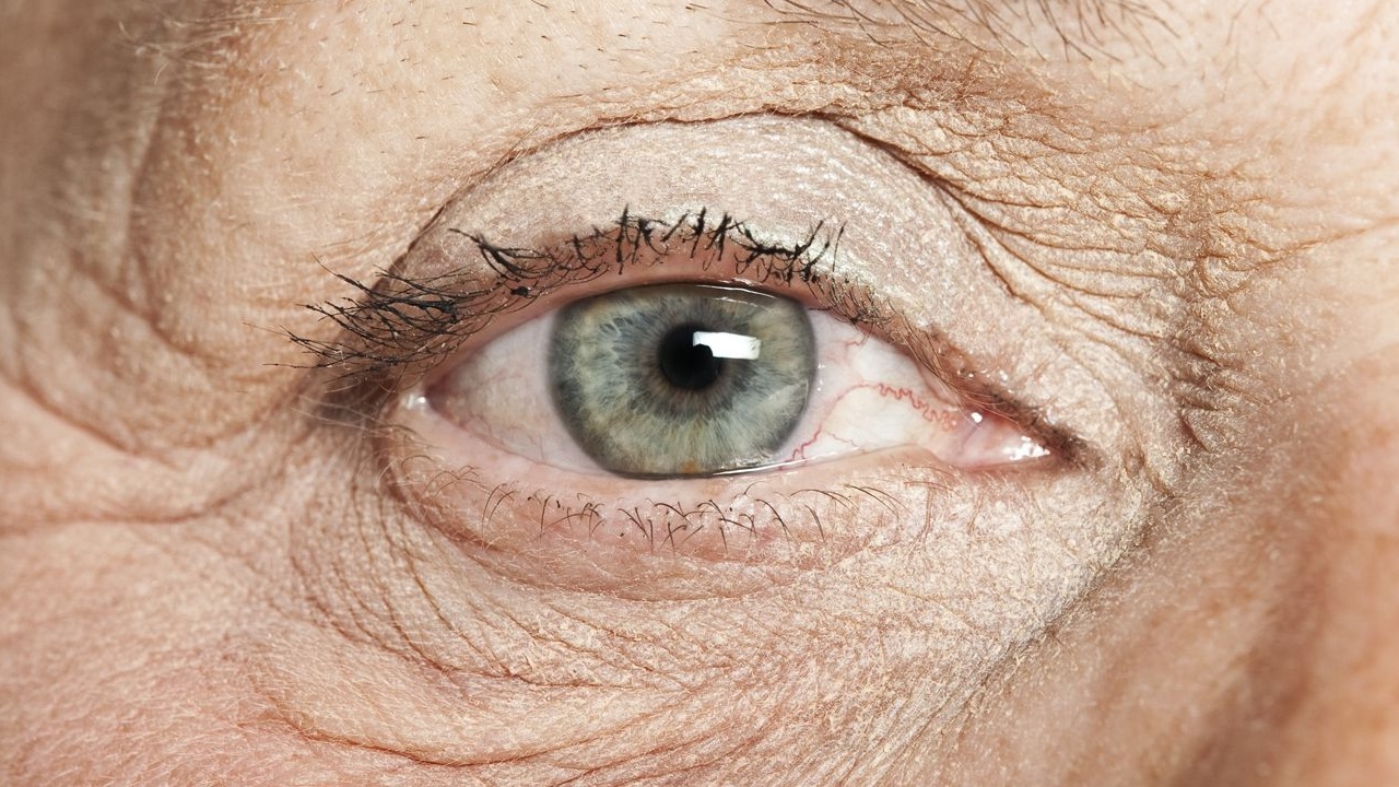 Görme Bozukluklarının Demansı 12 Yıl Önceden Teşhis Etmeyi Sağladığı Ortaya Çıktı