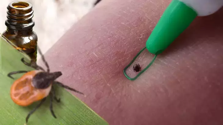 Parkta, bahçede artıyor! Keneden yüzde 100 koruyan doğal çözüm, evde hazırlayın