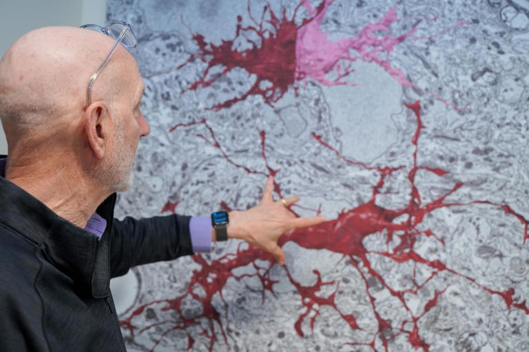 Yapay Zeka Beyin Haritası Alzheimer ve Otizm’in gizemini çözmeye yardımcı olabilir