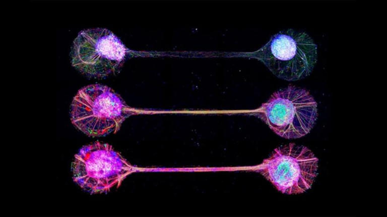 Mini beyinler kablolu: Bilim adamları laboratuvarda beyne benzer düşünme dokuları yetiştiriyor