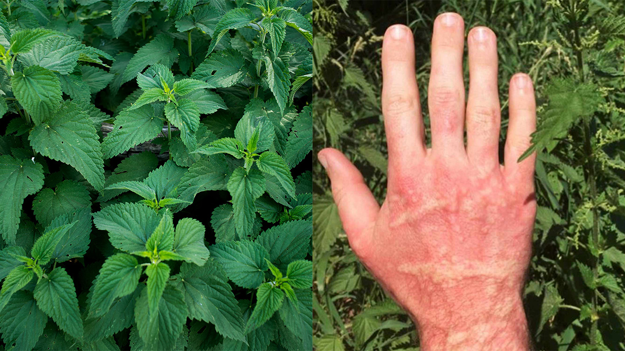 Isırgan Otu Neden Cildimizi Sanki İğne Batmışçasına Yakar?
