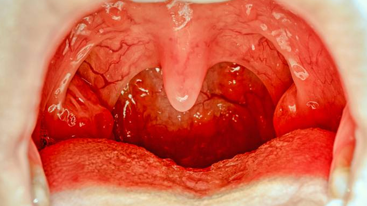 Ağız Boşluğumuzda Yer Alan ‘Küçük Dilimiz’ Tam Olarak Ne İşe Yarıyor, Olmasaydı Ne Olurdu?