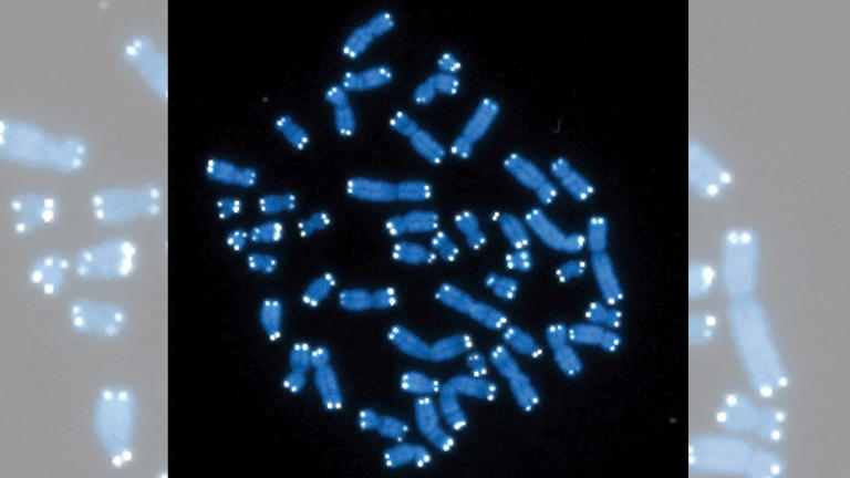 Araştırmacılar, zihinsel engelliliğe neden olan bir bozukluğun ardındaki tek ve şaşırtıcı bir gen buldu