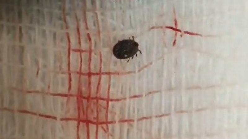 Ağrı şikayetiyle doktora gitti, gözünde canlı kene çıktı