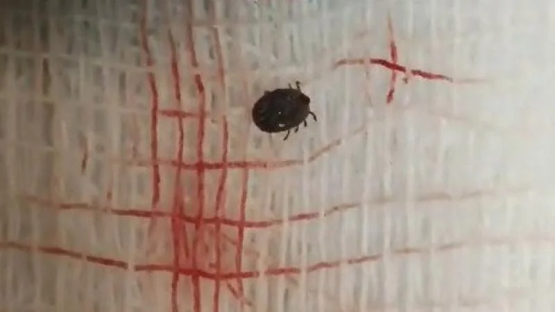 Ağrı şikayetiyle doktora gitti, gözünde canlı kene çıktı