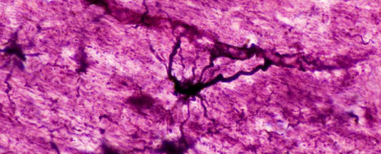 Kafamızın İçinde Saklanan Garip ‘Hibrit’ Beyin Hücreleri Keşfedildi