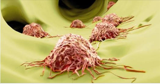 Çığır açan keşif kanseri tedavi edilebilir bir hastalığa dönüştürebilir