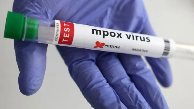 Avrupa’da maymun çiçeği virüsü uyarısı: Risk düşük ancak hazırlıklı olunmalı