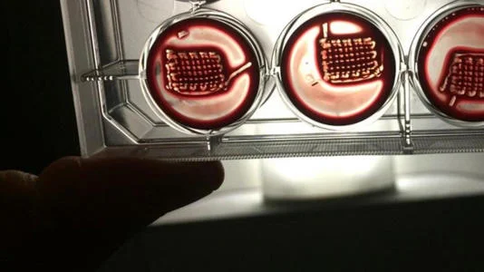 Bilim insanları, yaralanmalar ve hastalıklarla savaşmak için kanı kemik onarımında süper güce dönüştürüyor