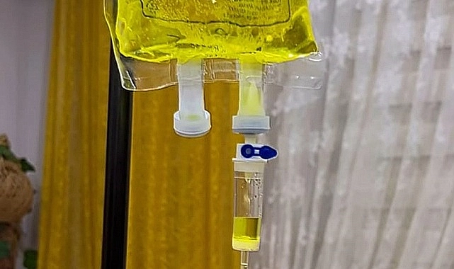 Halk Arasında ‘Atom’ Olarak Bilinen Sarı Serum Öldürüyor mu?