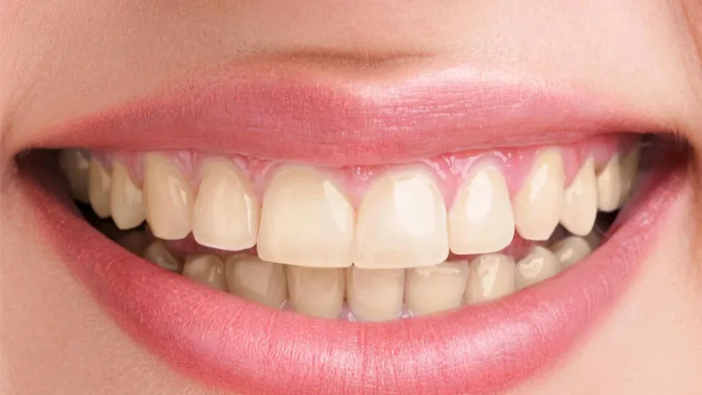 Şekerli Yiyecekler Neden Bazen Dişlerimize Ani Bir Ağrıya Neden Oluyor?