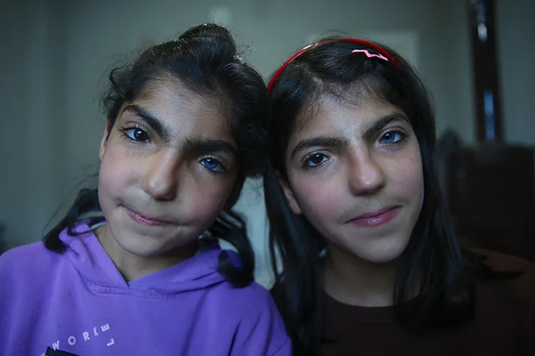 Farklı göz renkleri olan kız kardeşler görenleri şaşırtıyor