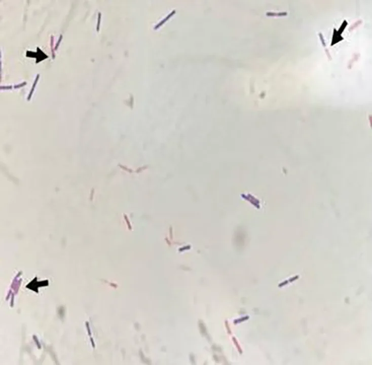 İstanbul Üniversitesi’ndeki bilim insanları uçak yakıtında yeni bir bakteri cinsi keşfetti