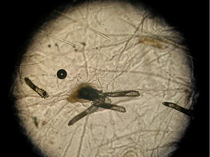 Uyurken yüzümüzde çiftleşiyorlar: Gece ortaya çıkan böcekler