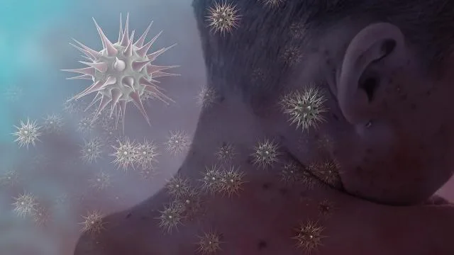 Kızamık Amerika kıtasında yayılıyor: Meksika ve Kanada’daki salgınlarda ölümler yaşandı