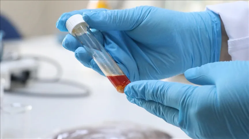 Tekirdağ’da üzüm atığından yüksek değerli tek hücre yağı üretildi