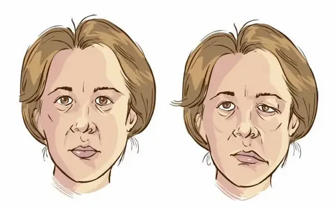 Sinüzit ve yüz felci hakkındaki doğru bilinen yanlışlar!