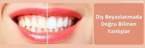 Diş beyazlatmada doğru bilinen yanlışlar!