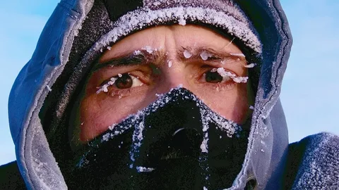 Donma mı, hipotermi mi?