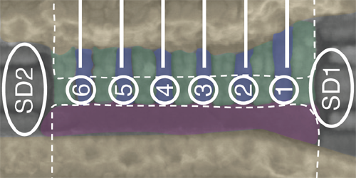 Spin Tabanlı Bir Kuantum Bilgisayarı Kıyaslama