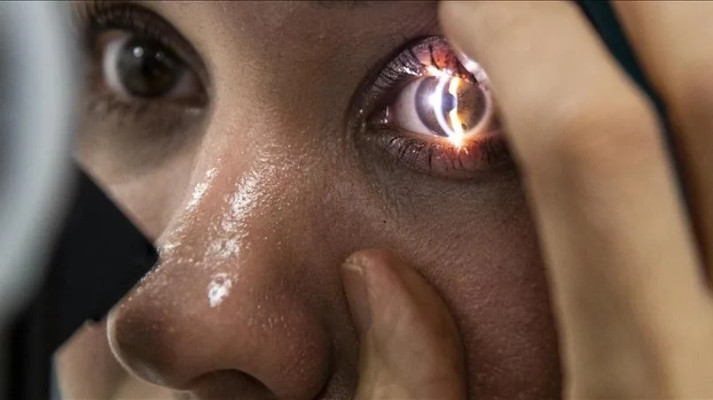 Yapay zekaya güvenilerek ihmal edilen göz sağlığı tedaviyi zorlaştırıyor