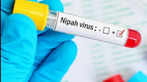 Nipah Virüsü (Niv) ile İlgili Merak Edilenler