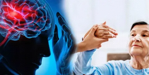 Türkiye’de ve dünyada inme (felç), en sık görülen nörolojik hastalıklar arasında yer alıyor.