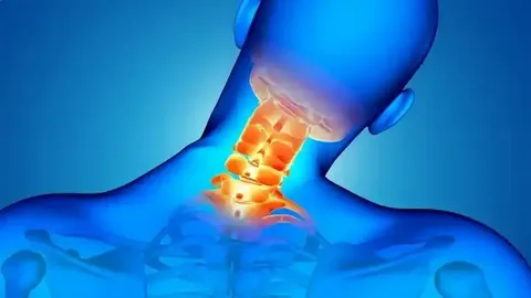 Boyun fıtığında nörolojik belirtiler önem taşıyor!